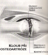 klouby-osteoporoza200.jpg klouby-osteoporoza200.jpg